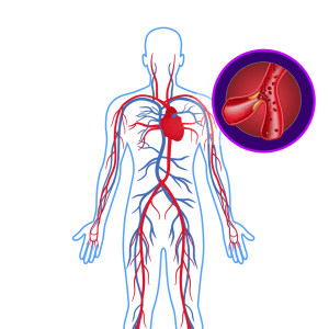 Cholesterol & Triglycerides Control