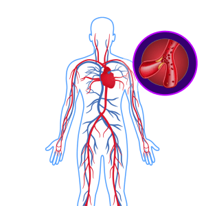 Cholesterol & Triglycerides Control