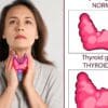 Control Thyroid: Guggul's Surprising Health Benefits!