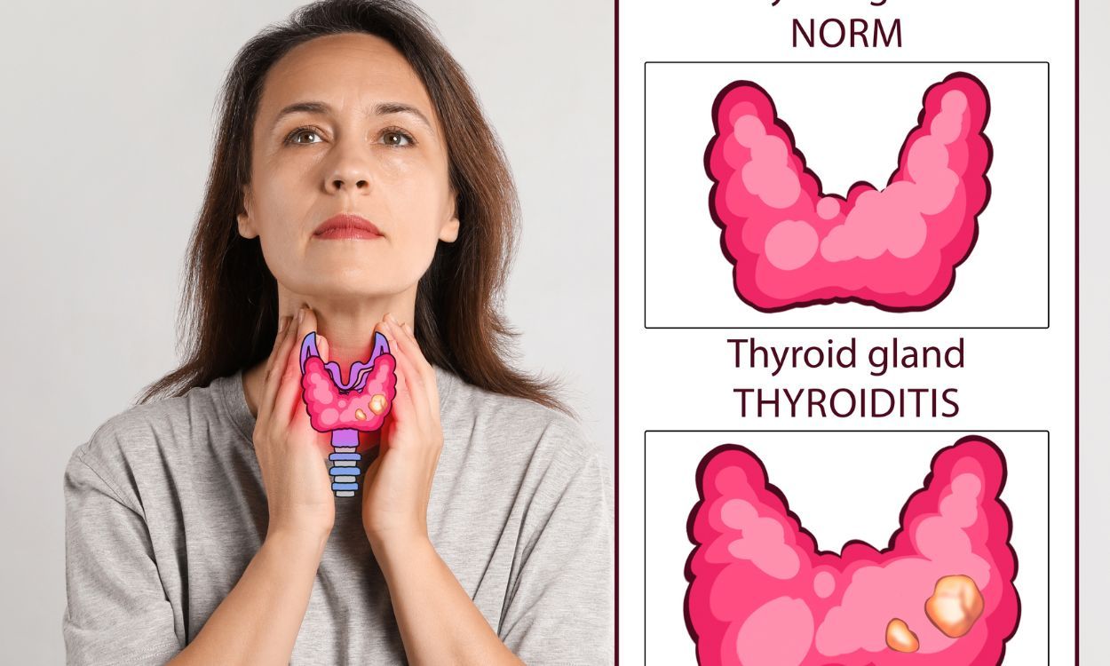 Control Thyroid: Guggul's Surprising Health Benefits!