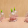 Acupuncture for Thyroid Control: A Surprising Solution?