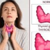 Can thyroid problems be cured? Find out!