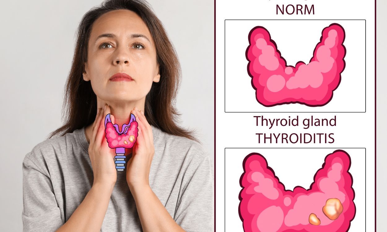 Can thyroid problems be cured? Find out!