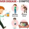 Understanding Graves' Disease: Symptoms and Treatment