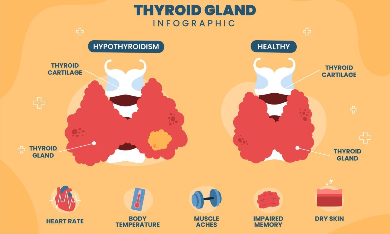 Understanding Thyroid Cancer: What You Need Know