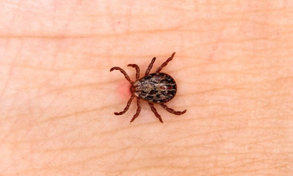 Treating Tick Bites: First Aid Tips and Disease Prevention - FITPAA