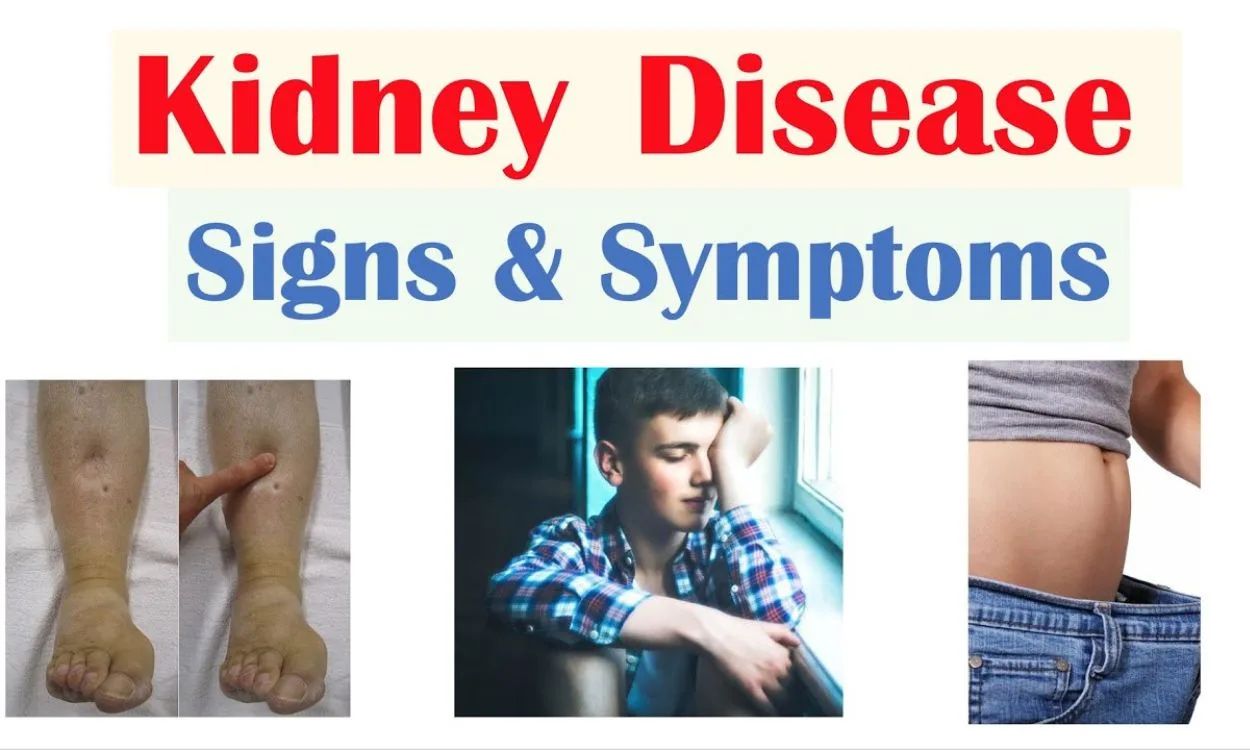 What are the symptoms of kidney disease? - FITPAA