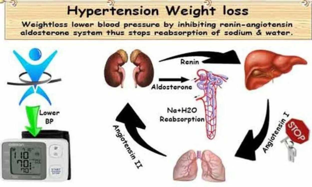 Hypertension and weight management